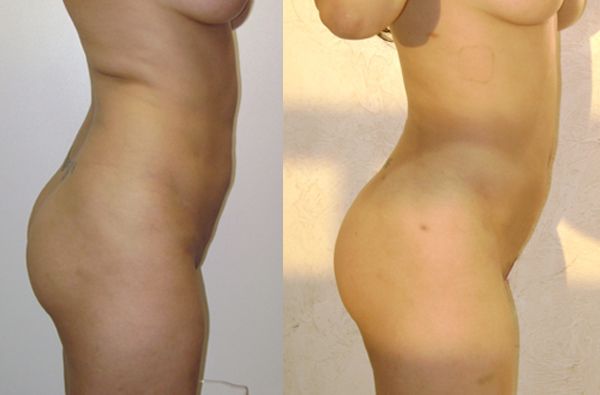 Edgar Ernesto Torres Mejía-3