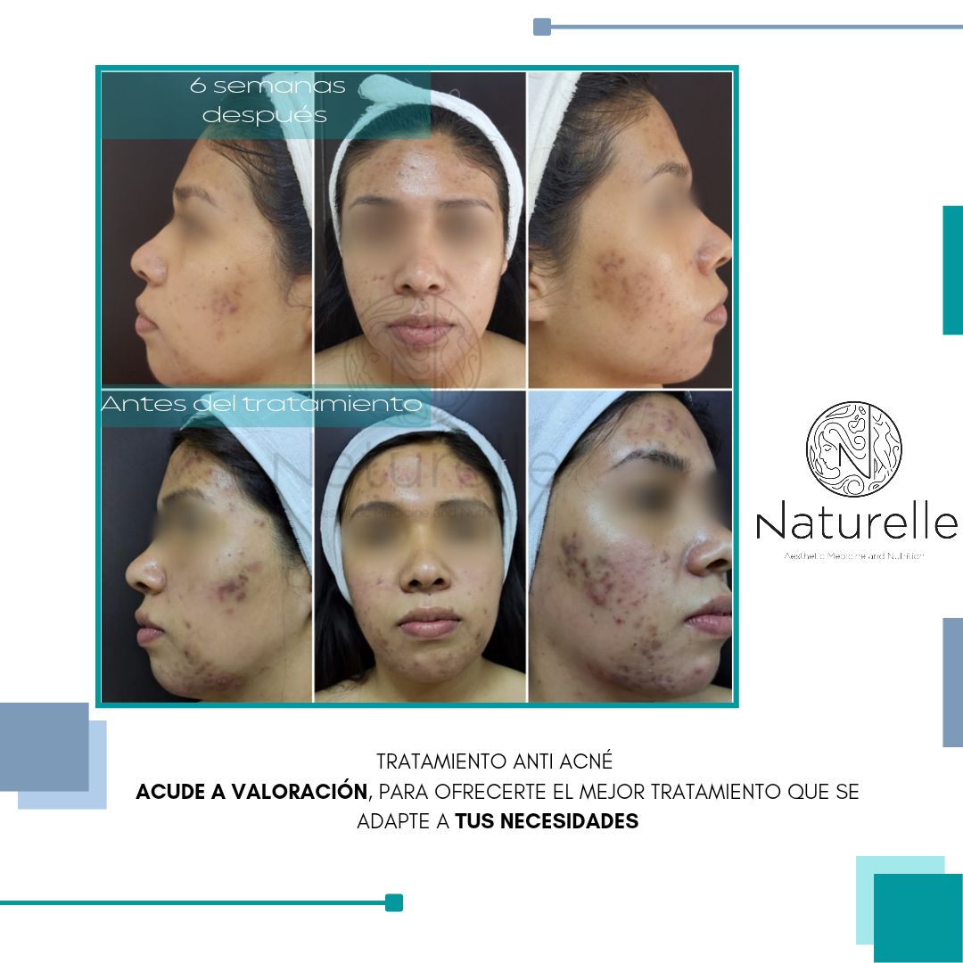 Daniel Marín Jasso-20