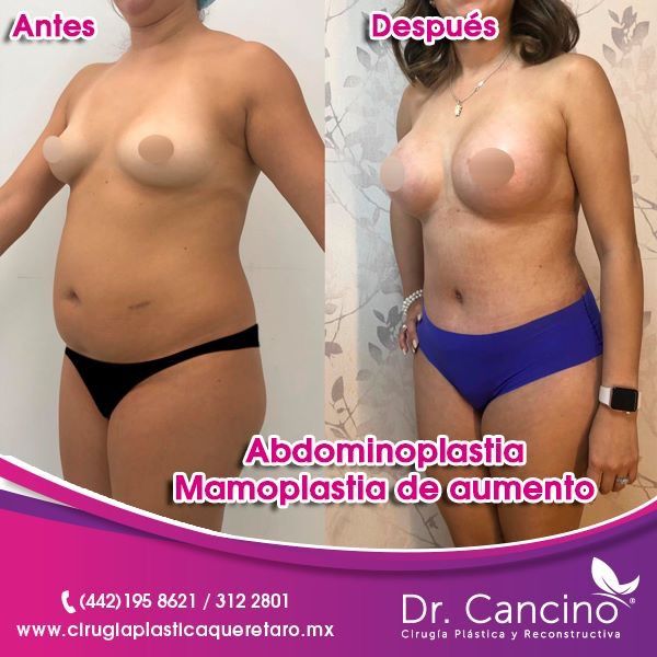 Luis M. R. Cancino-34