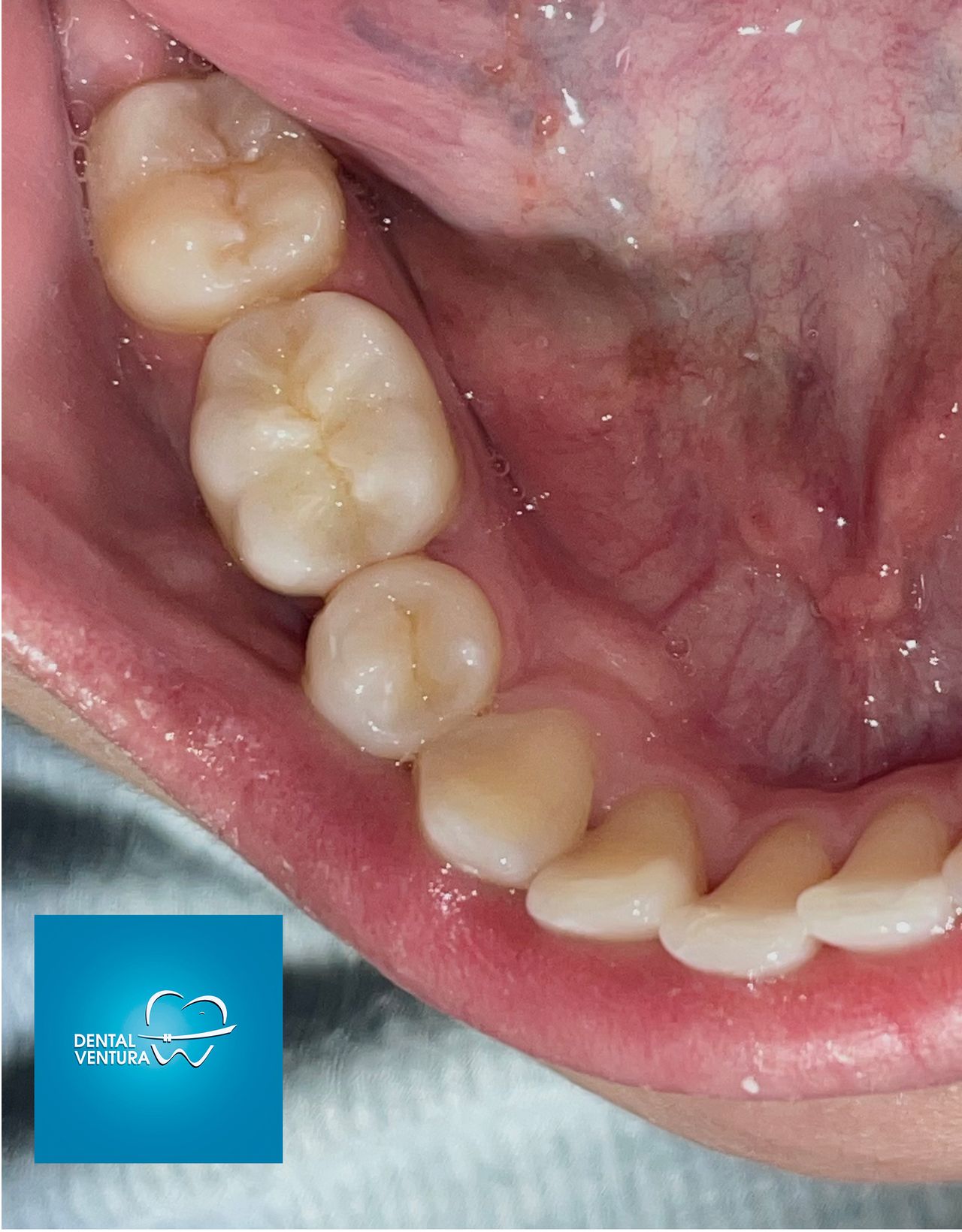 Antonio Cerda Ventura-2