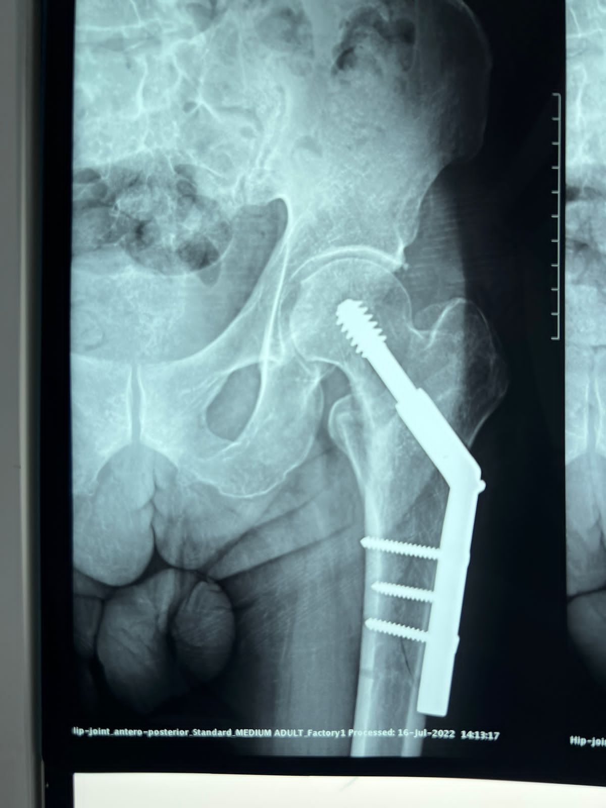 Oscar Alberto Pérez Peralta-20