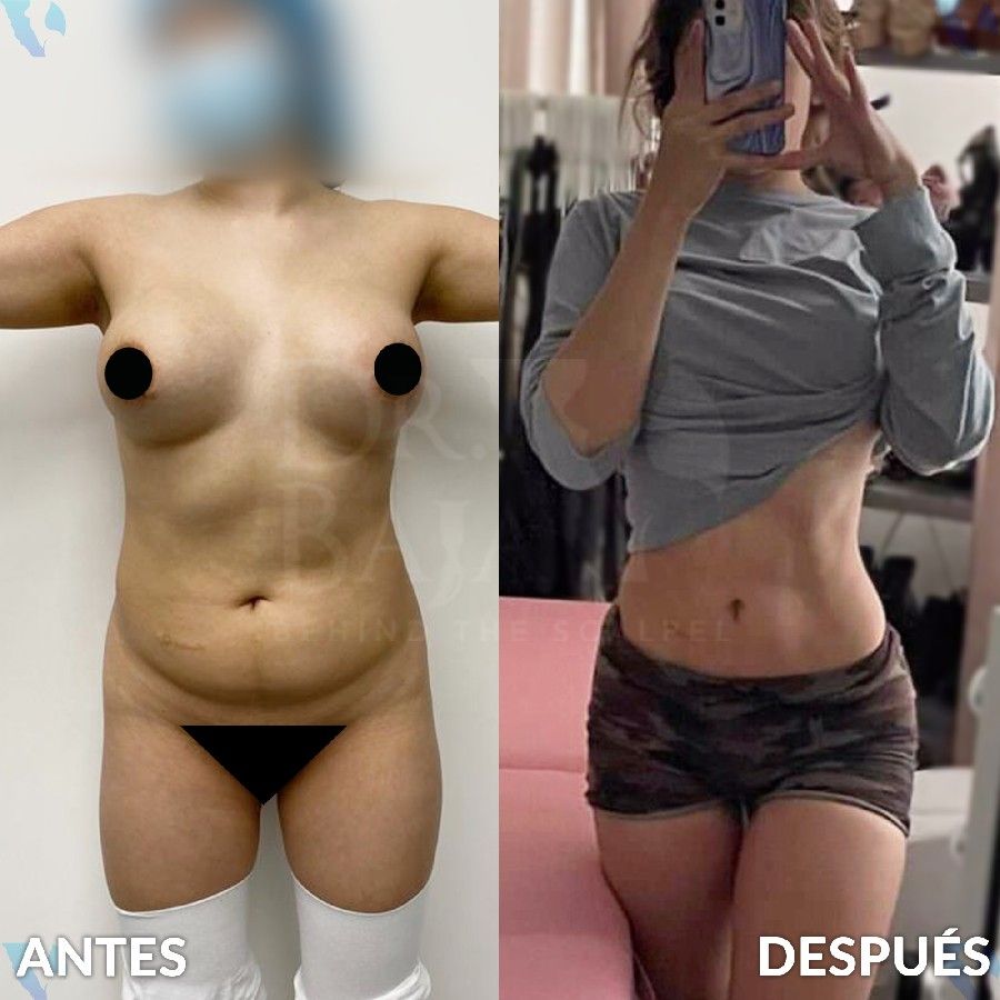 Renato Rodríguez Hirales-32