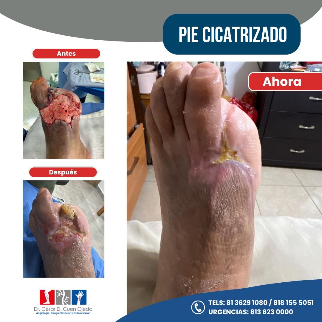 César Daniel Cuen Ojeda-3