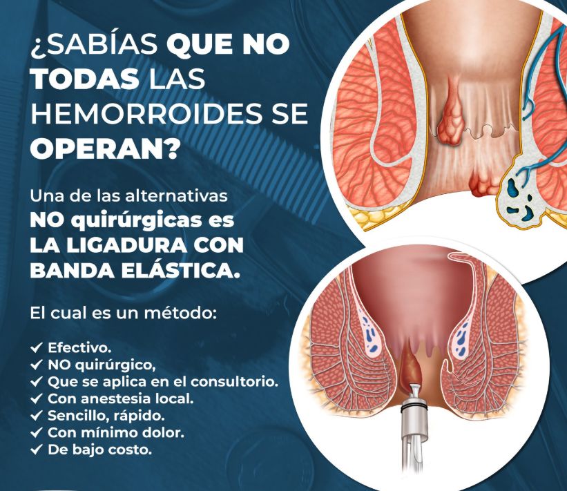 Néstor Cruz López-0