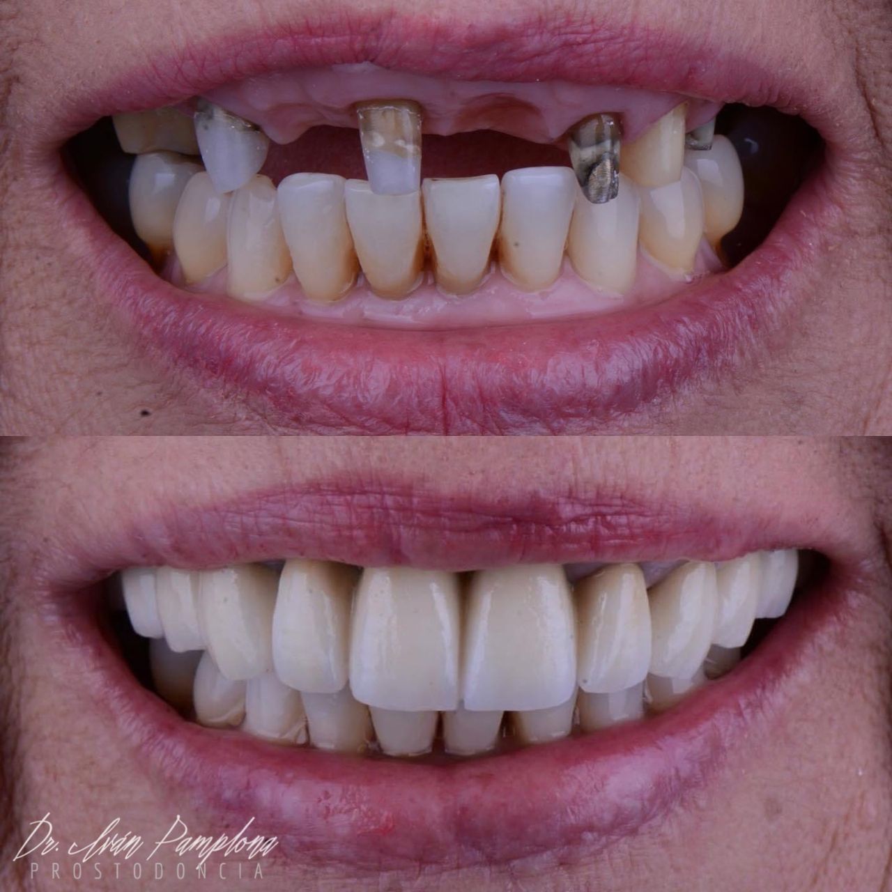 Iván Gerardo Pamplona Alfaro-8