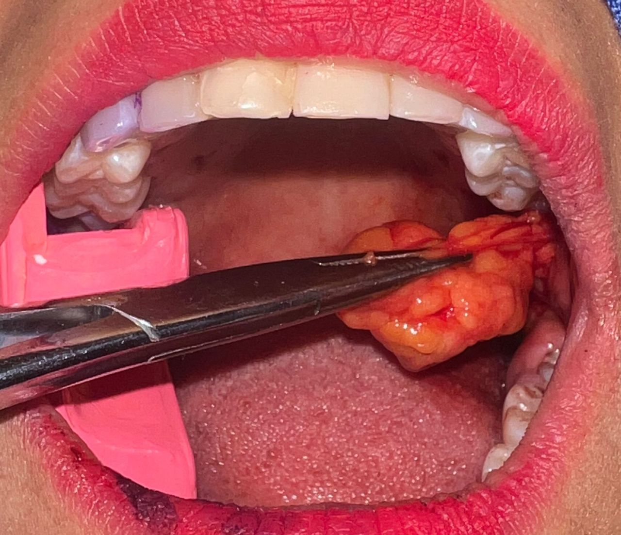 Jair Contreras García-6