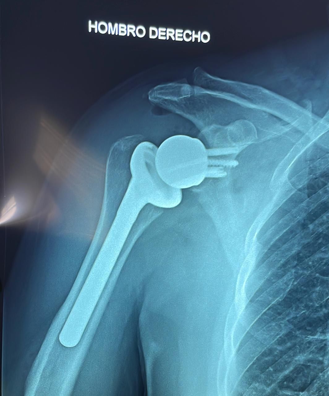 Josmar Adrián Lopez Eng-3