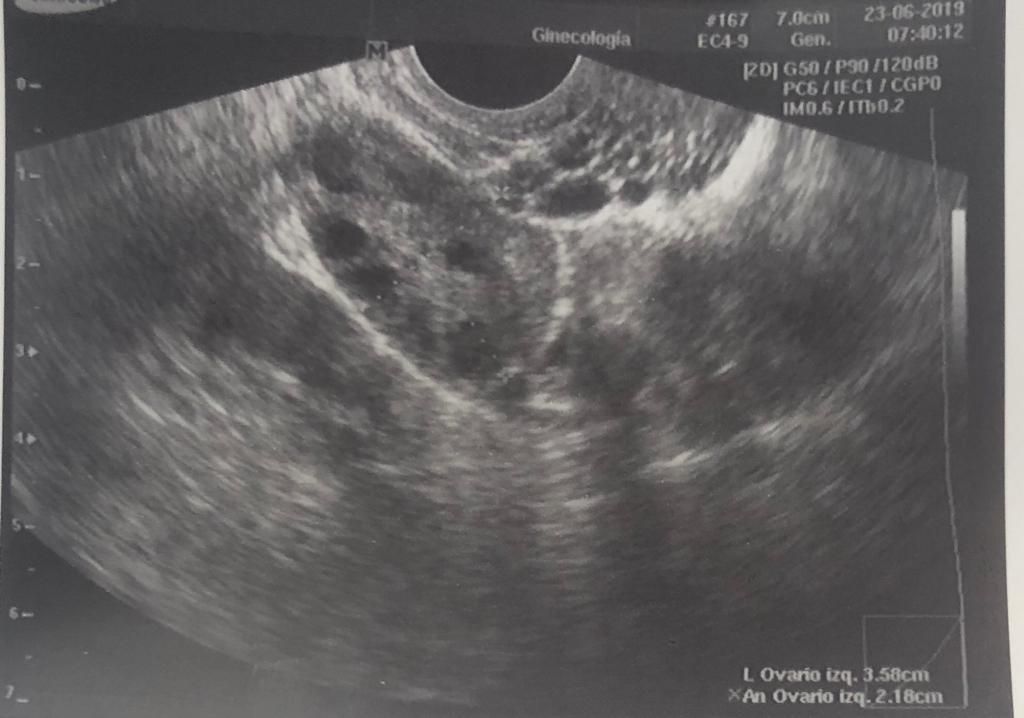 Imelda Zárate Fierro-10