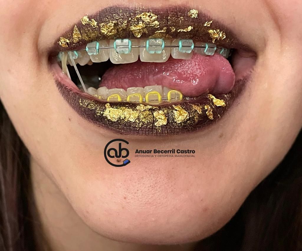 Anuar Becerril Castro-25