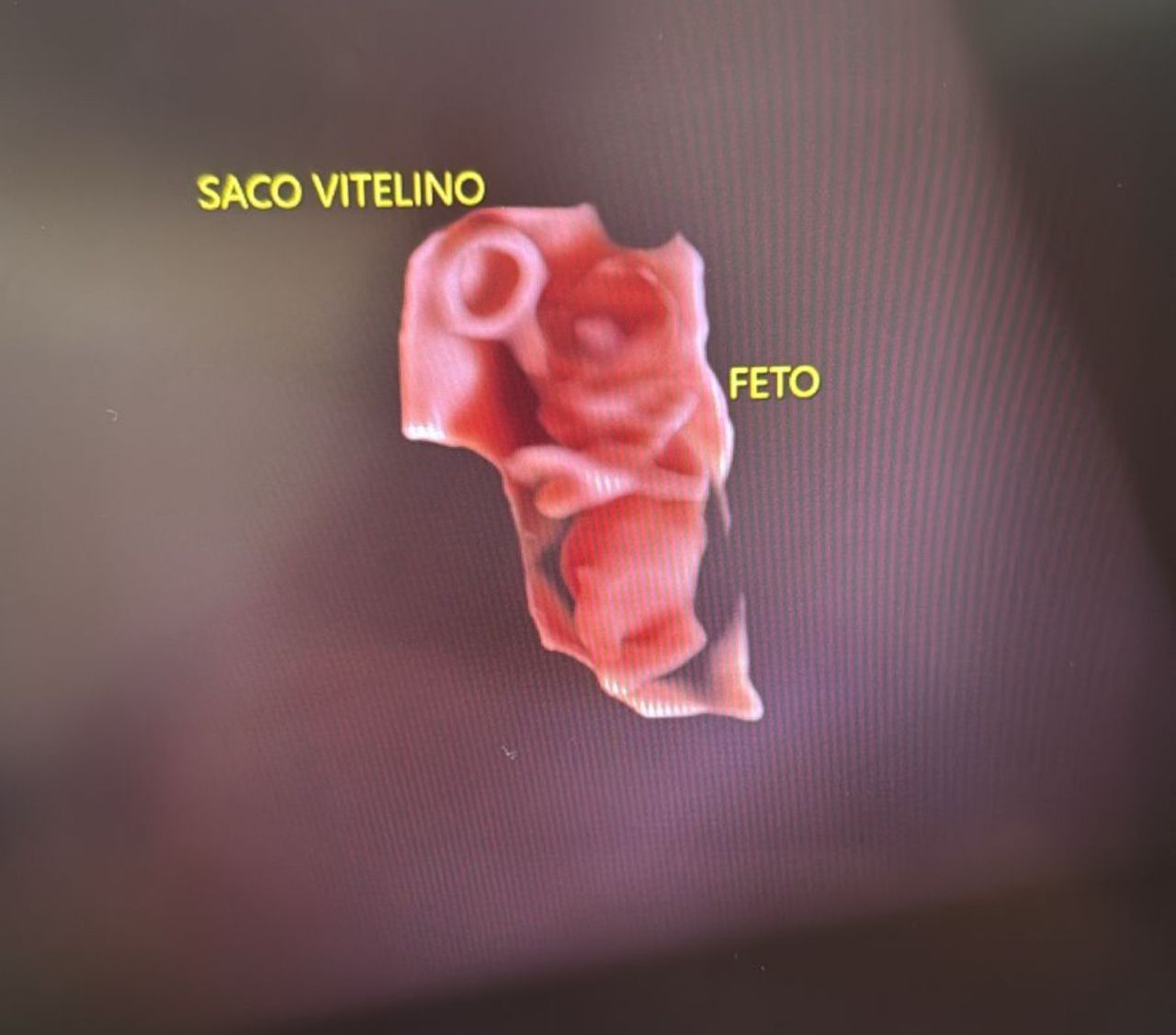 Carlos Ulises Romero Zarate-7