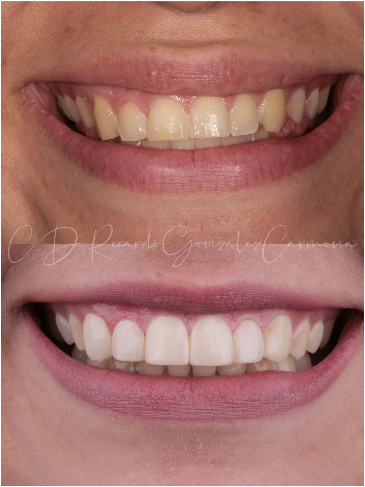 Ricardo González Carmona-8