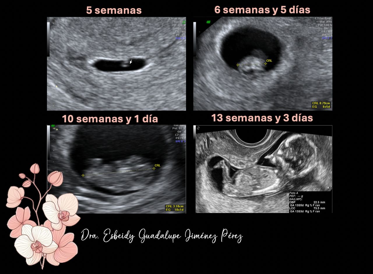 Esbeidy Gpe. Jiménez Pérez-23