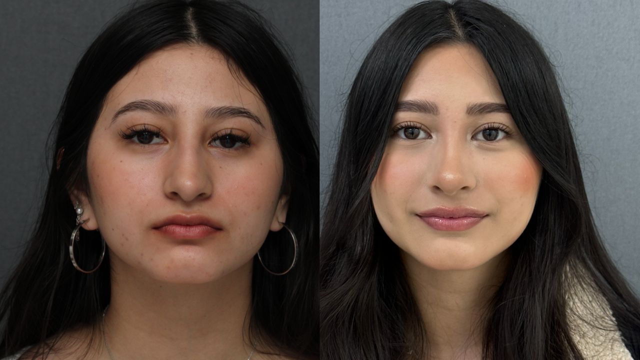 Angel Castro Urquizo-70