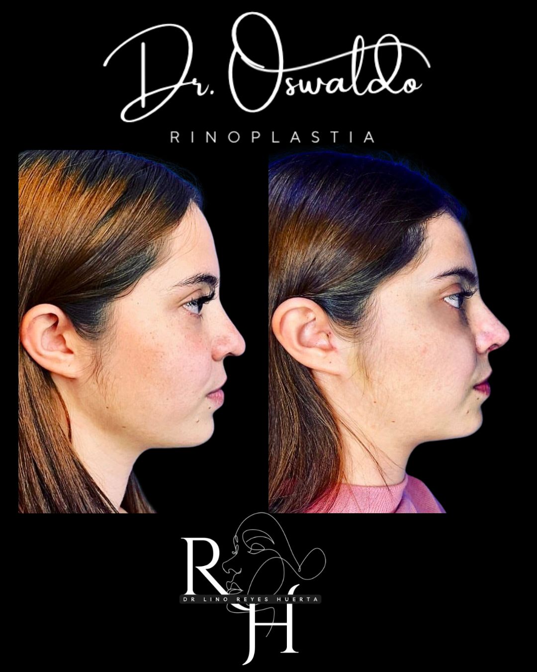 Lino Oswaldo Reyes Huerta-3