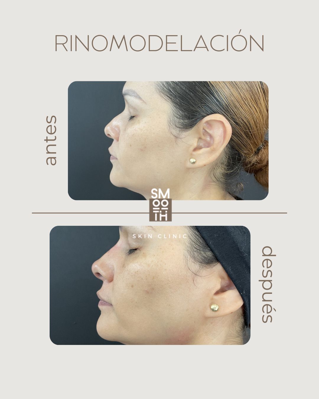 Samantha Martínez-84