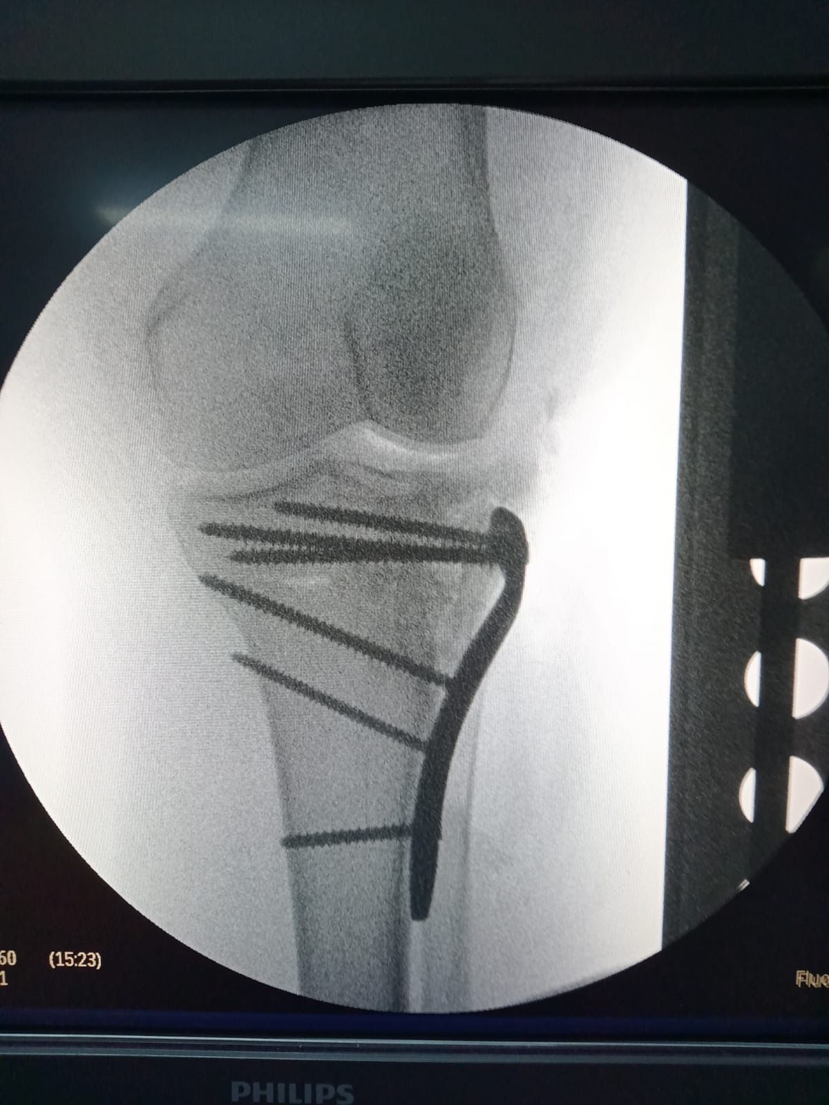 Luis Antonio Guillen Lopez-3