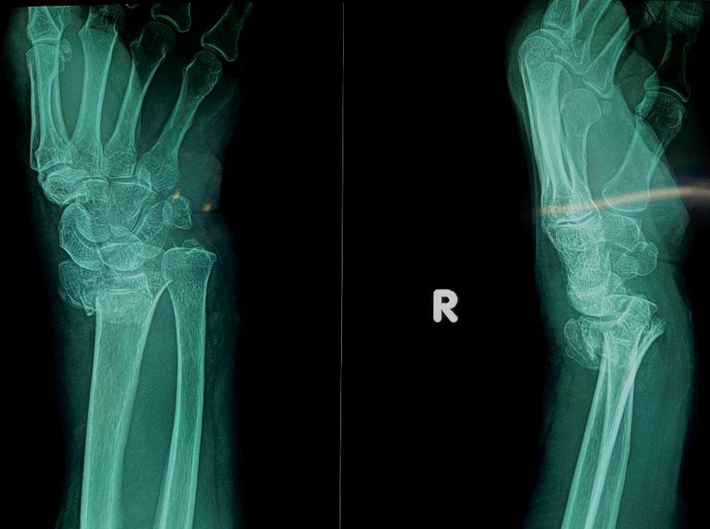 César Alejandro Moreno Palapa-11