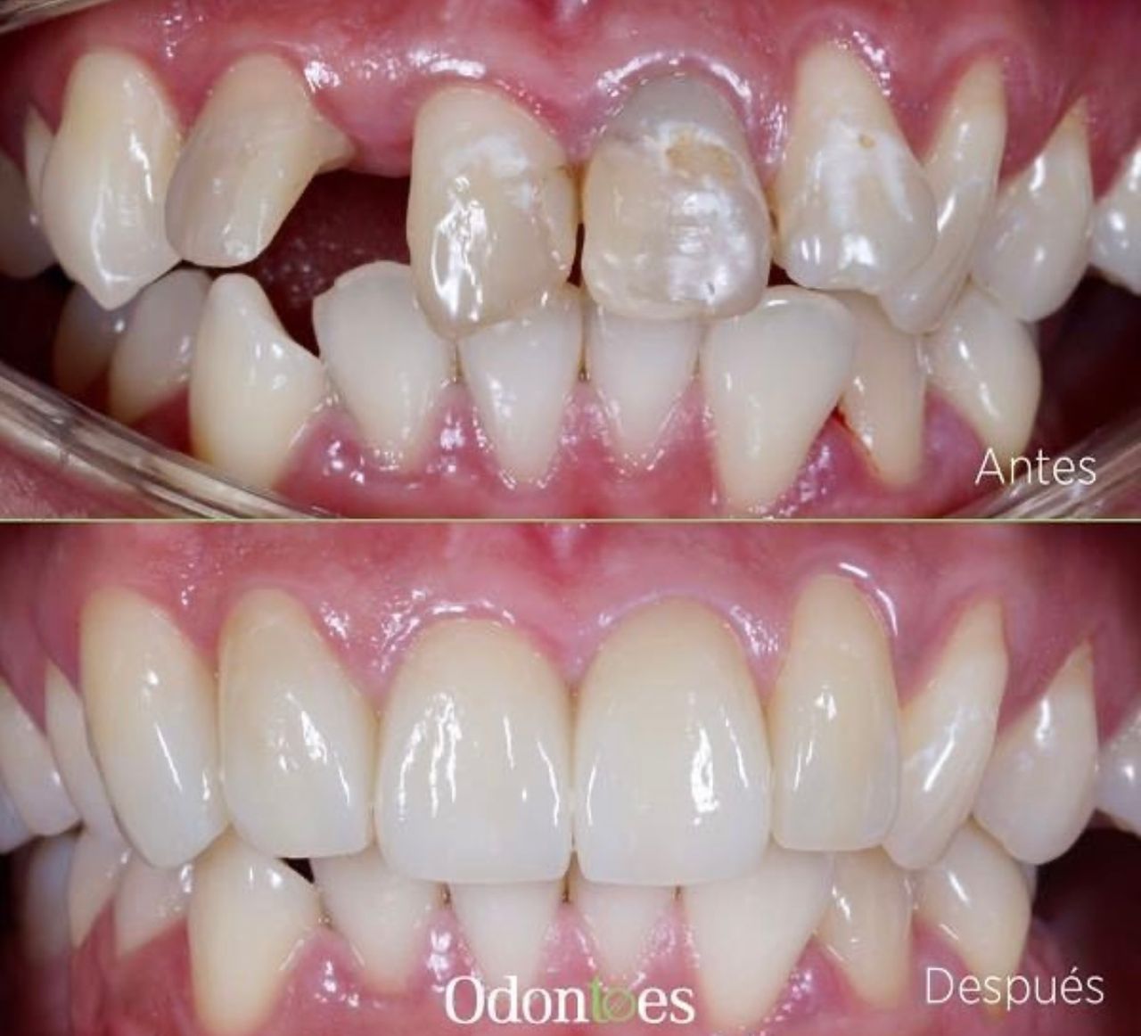 Raúl Euán Salazar-9