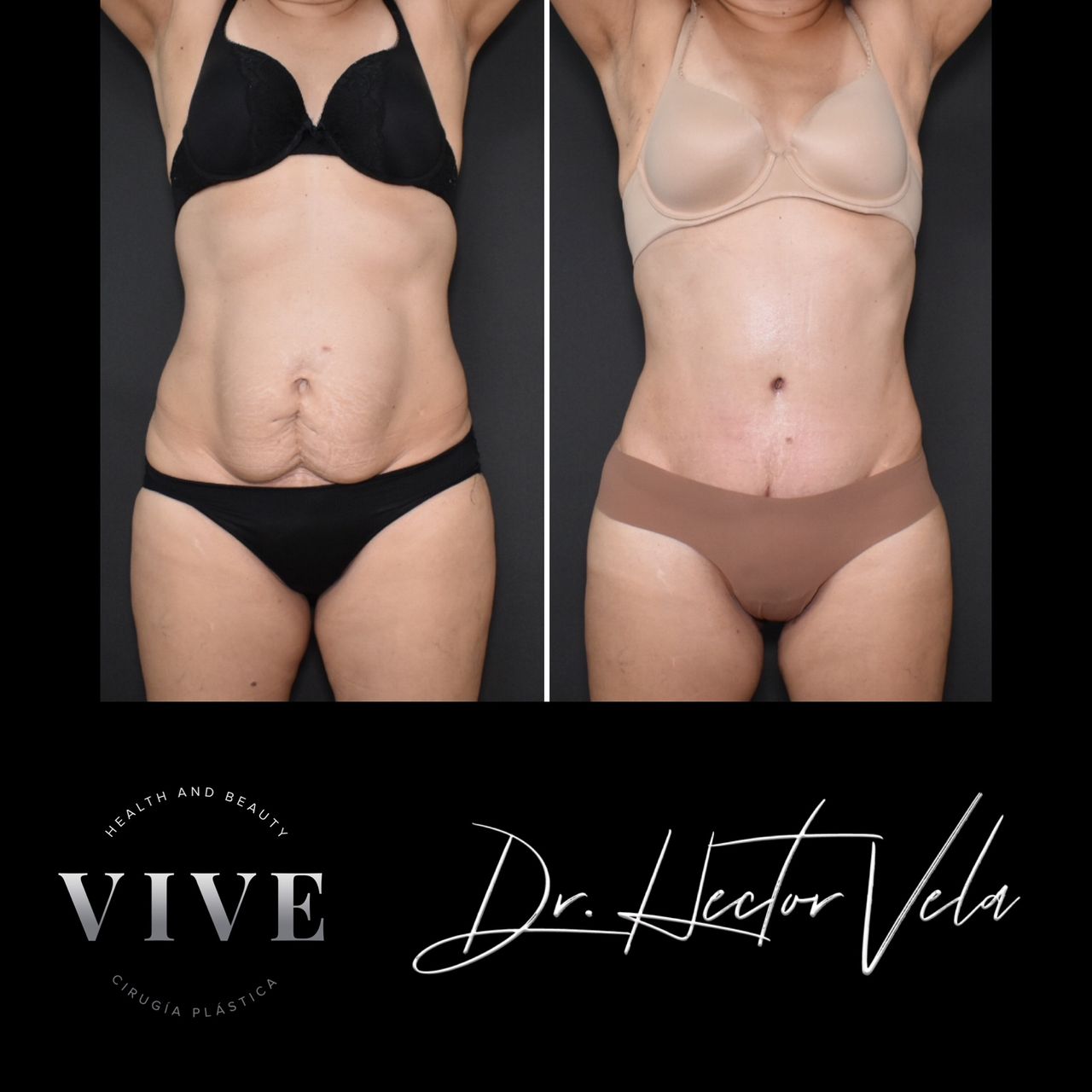 Héctor Eduardo Vela Cardona-171