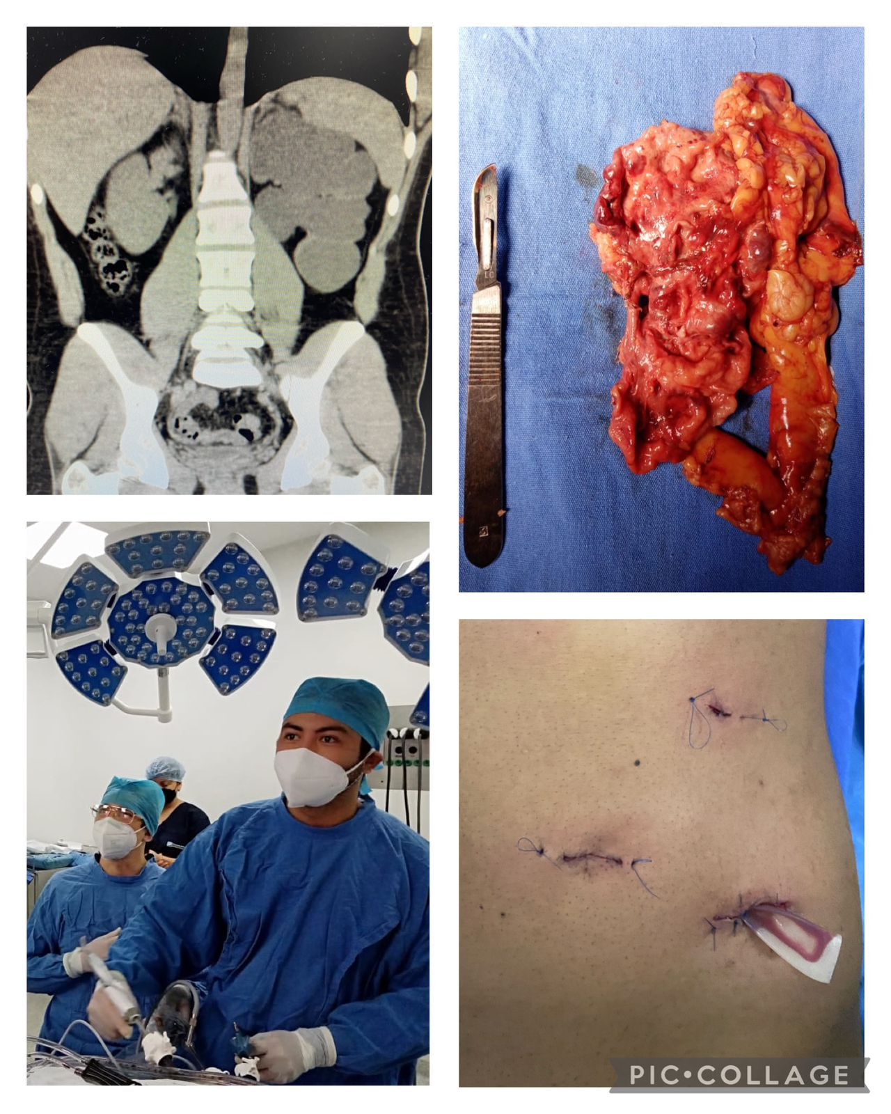 Ricardo Pérez Huerta-18