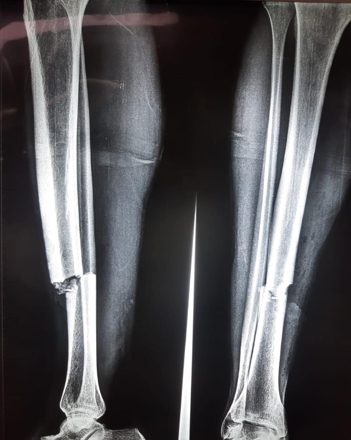 Felix Alfaro Arias-16