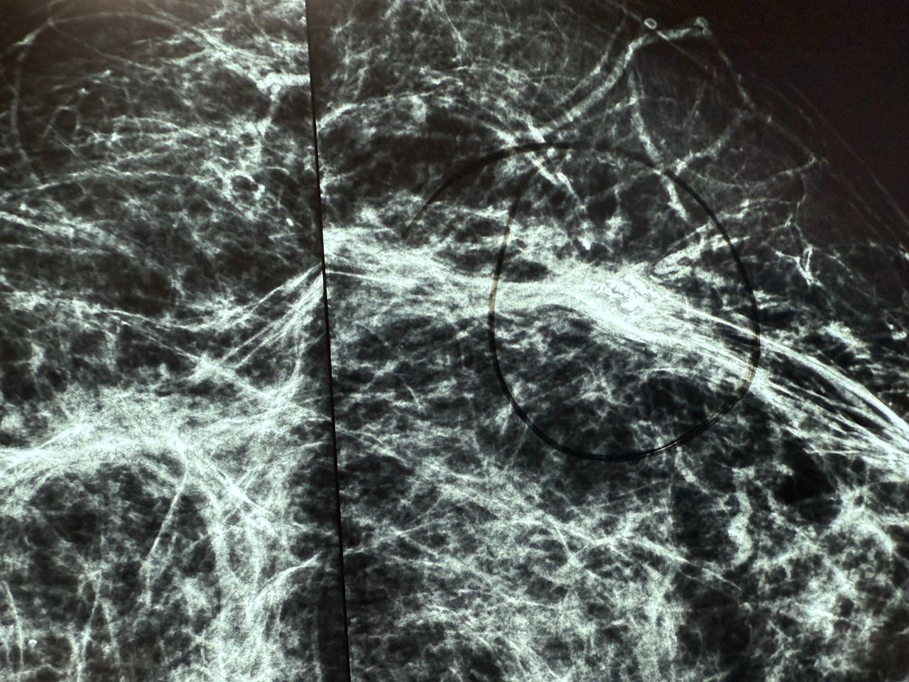 Christian Samuel Uitzil Colli-2