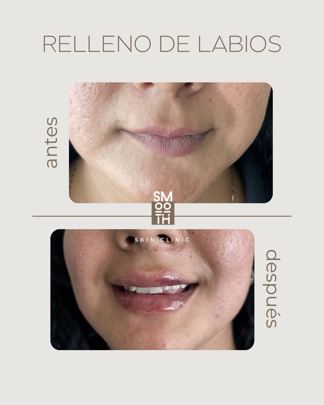 Samantha Martínez-80