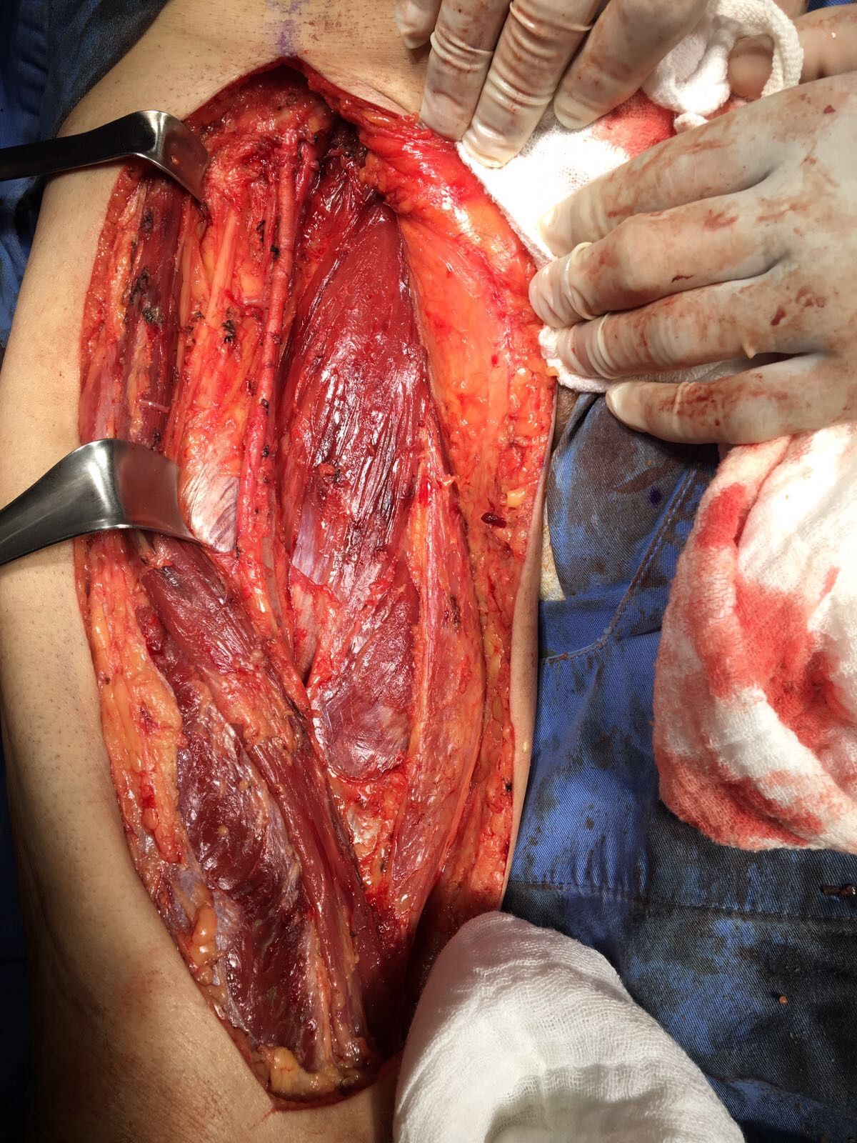 César Espejel Valdés-28