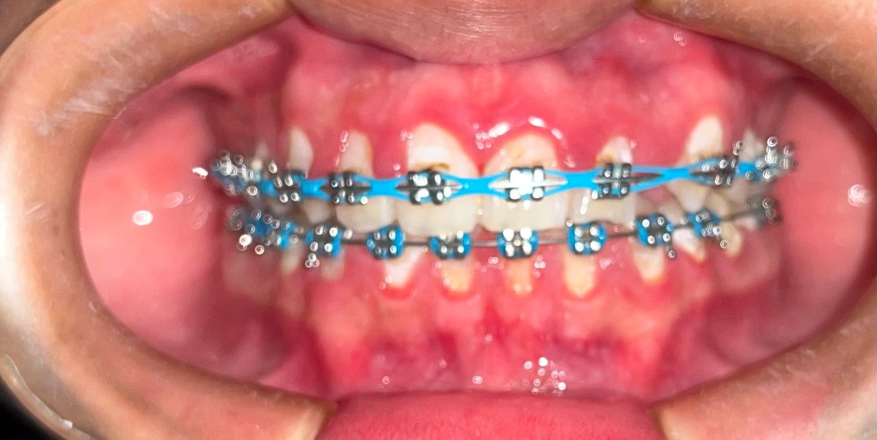 Zoe Guadalupe  Hernandez Aguilar-9