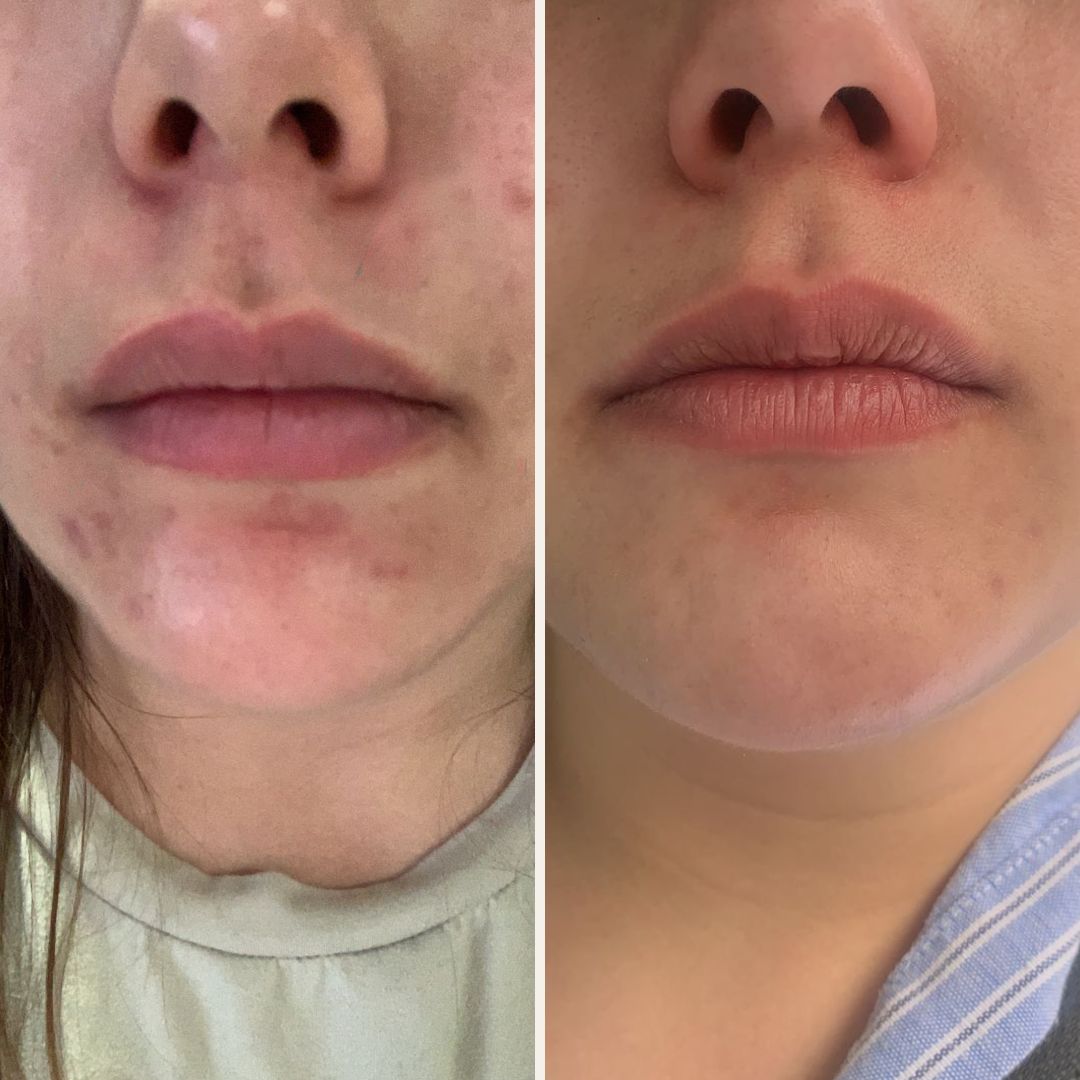 Alejandra Gutierrez García-34