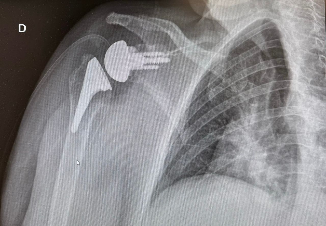 Miguel Fernando Gaytán Montoya-2