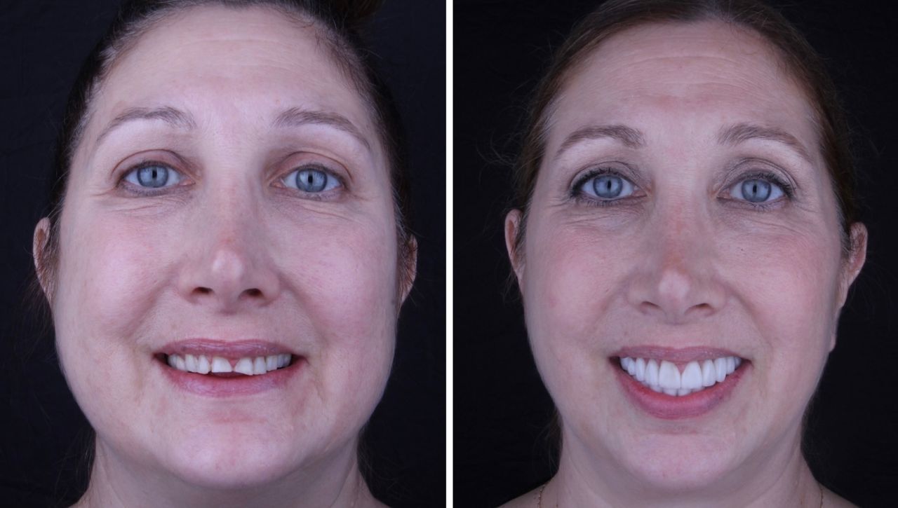 Josué Márquez Gómez-176