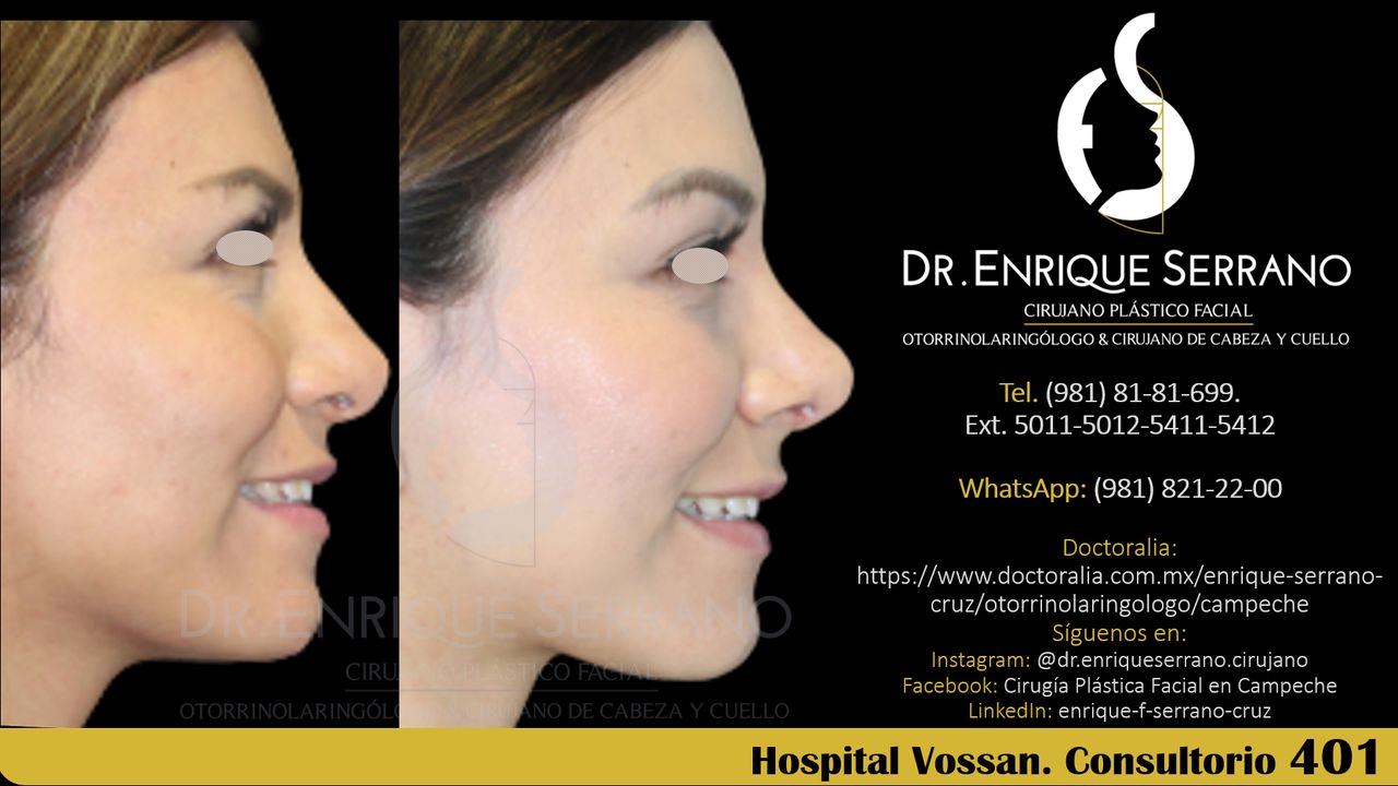 Enrique Serrano Cruz-107