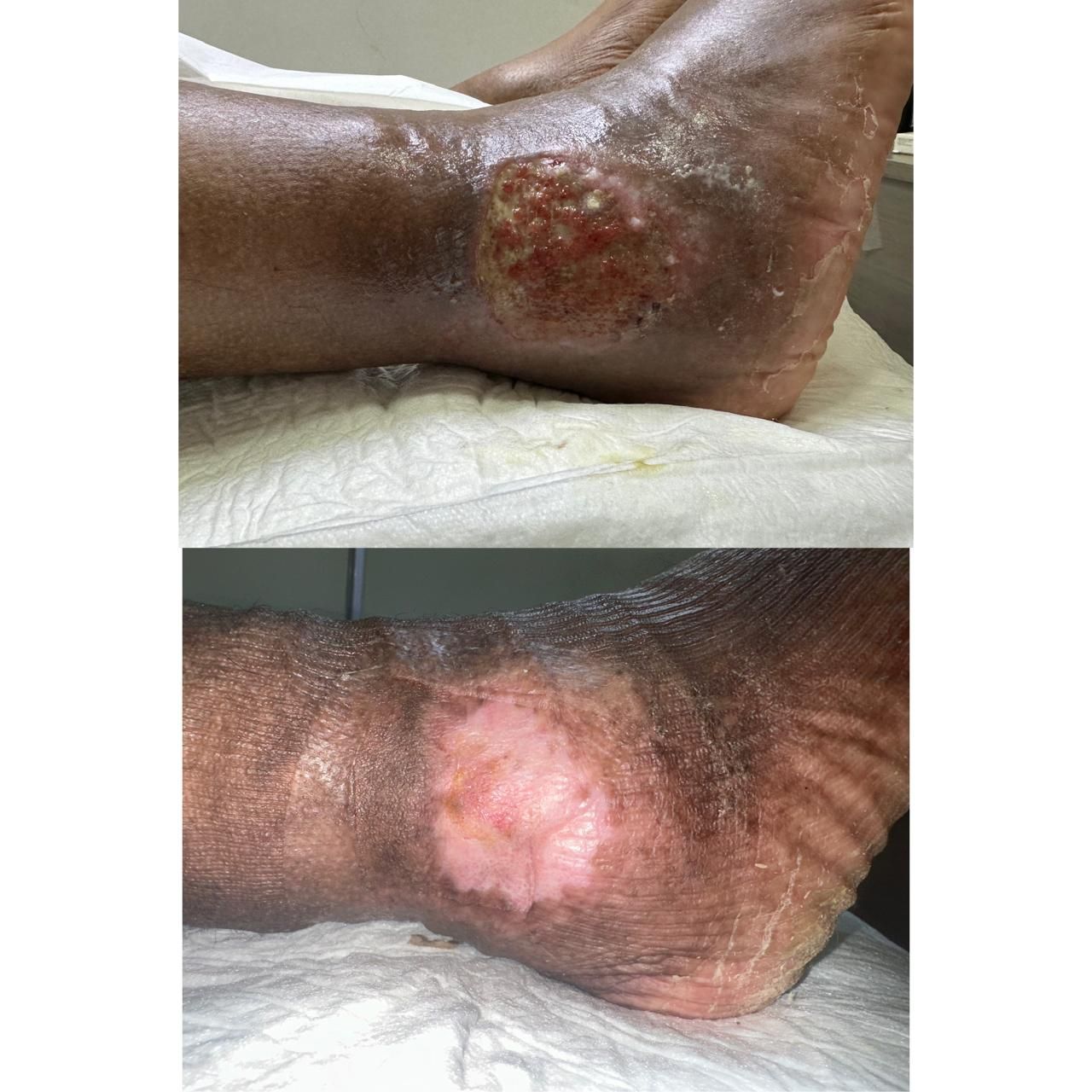 Jhonatan López González-37