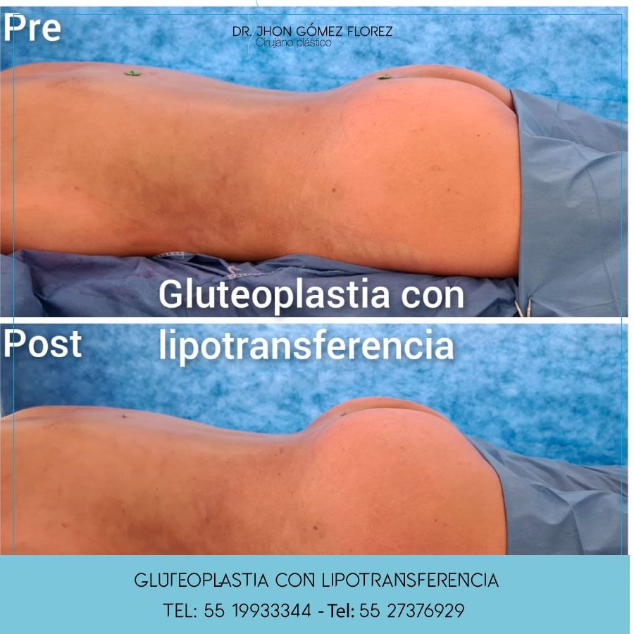 Jhon César Gómez Florez-22