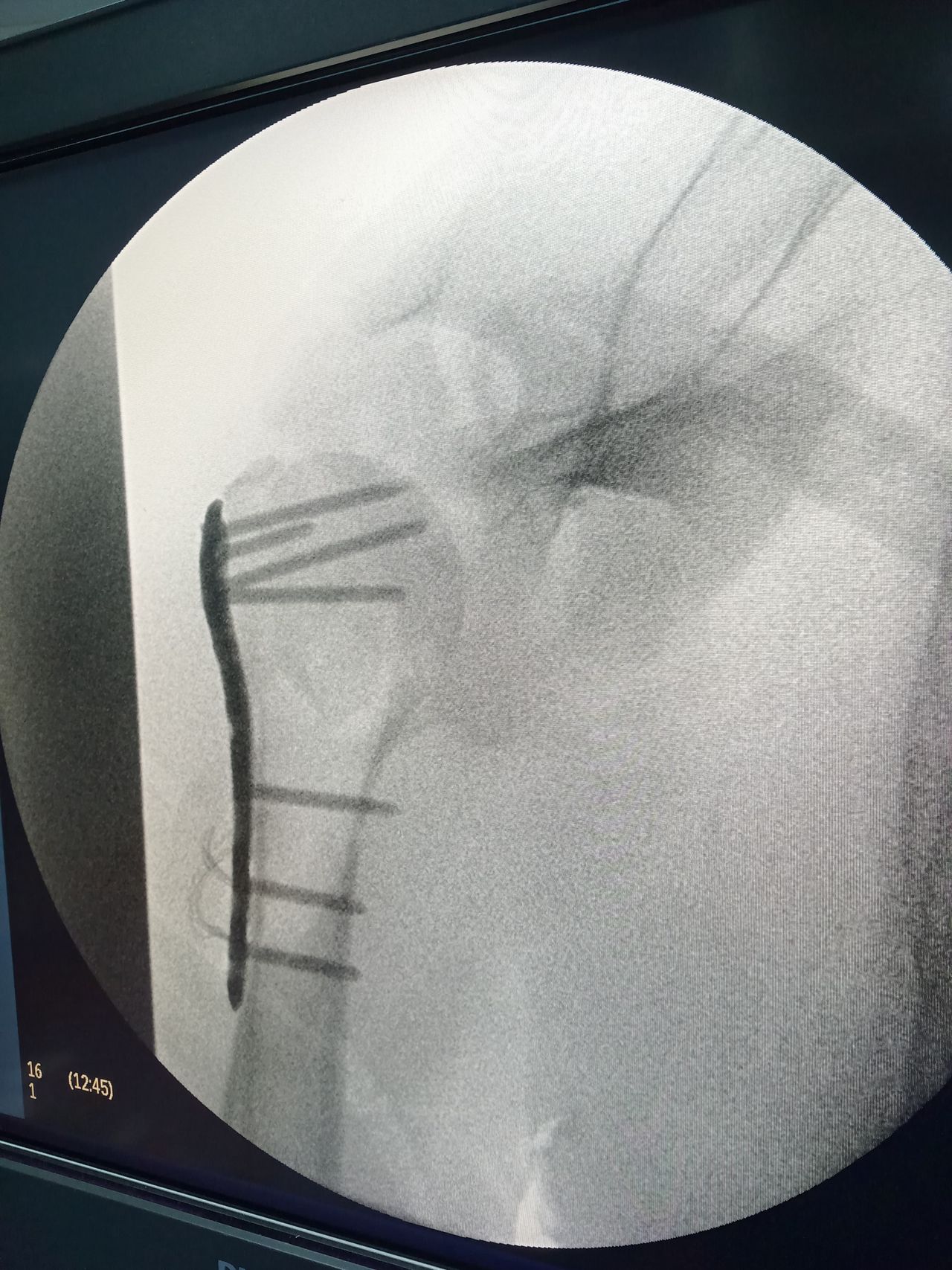 Luis Antonio Guillen Lopez-4