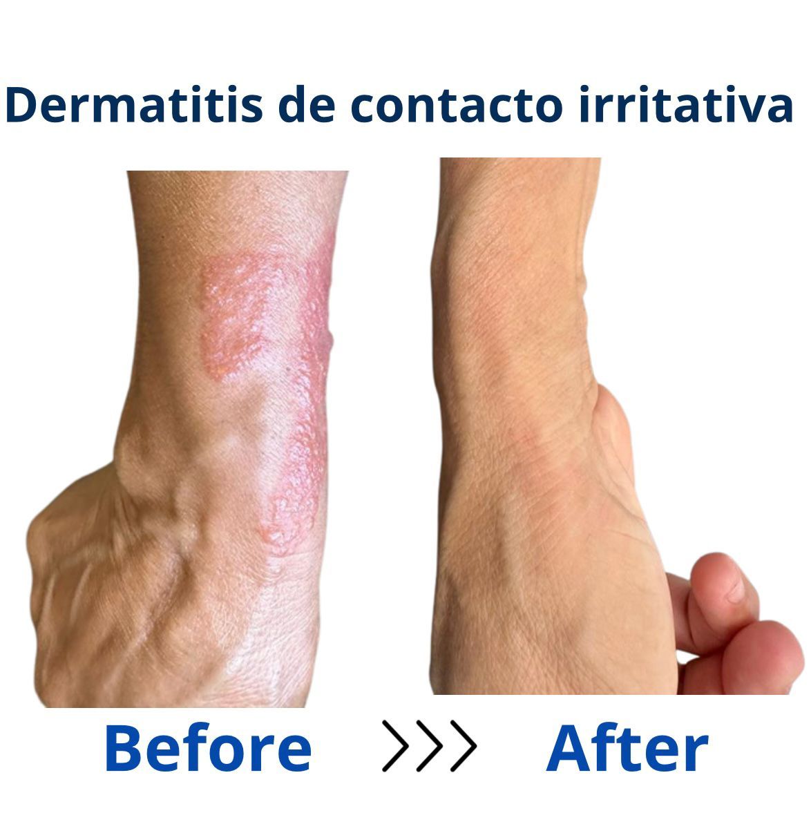 Itzel Anayn Flores Reyes-44