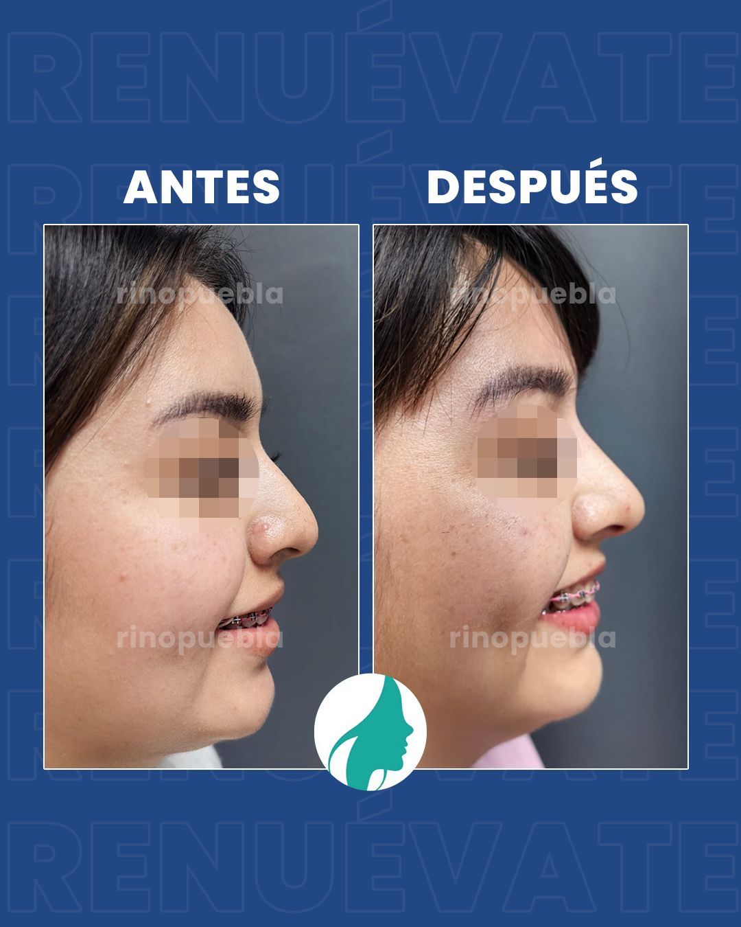 Christian Santander Becerra-21