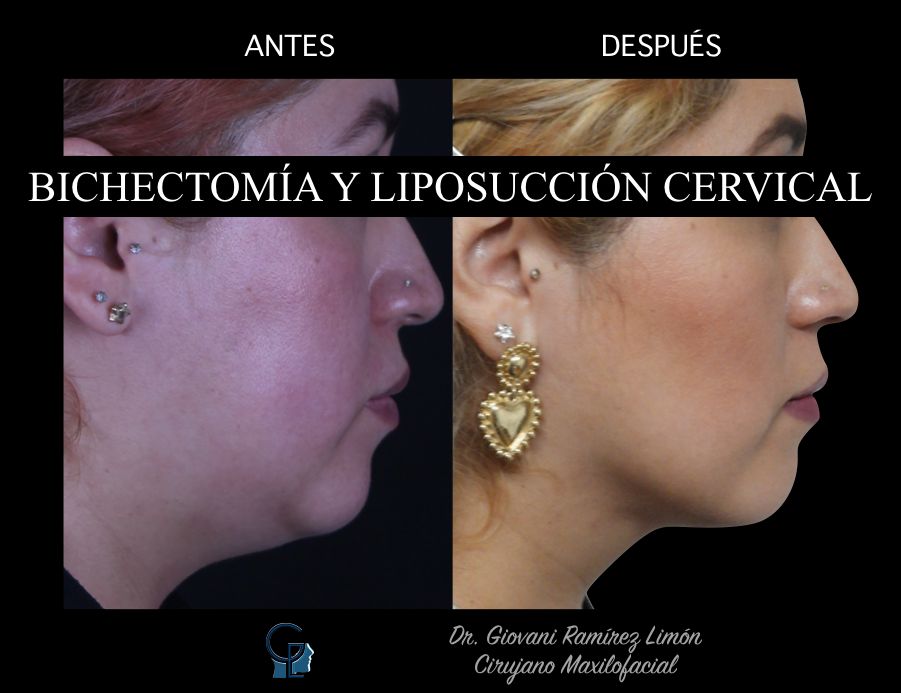 Giovani Ramírez Limón-19