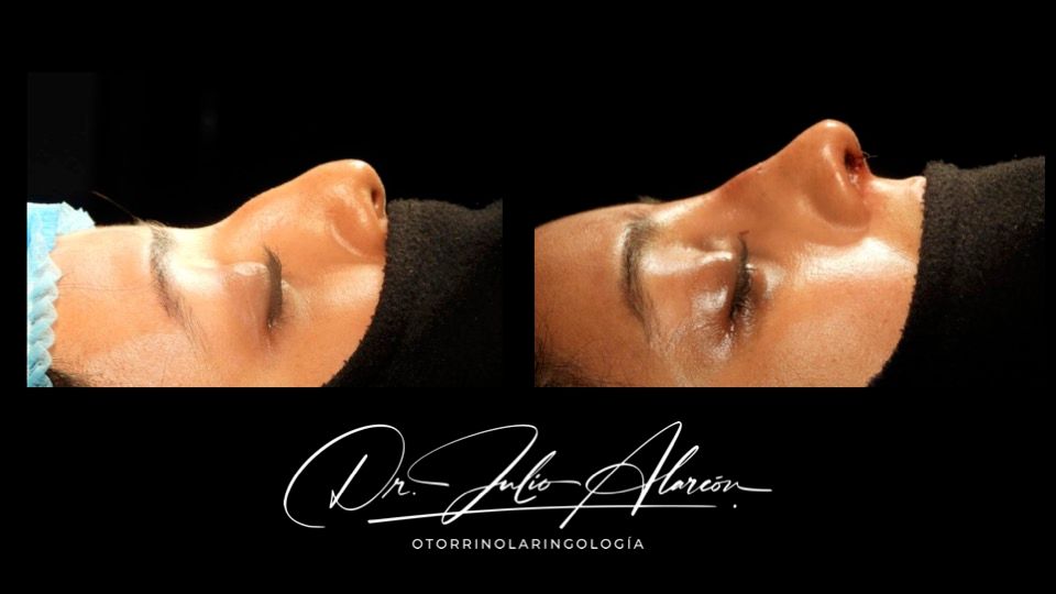 Julio César Alarcón Ortiz-3