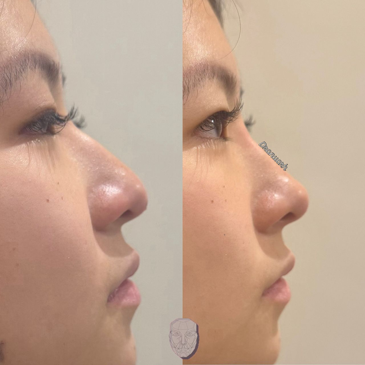 Anuar Hernández Flores-23