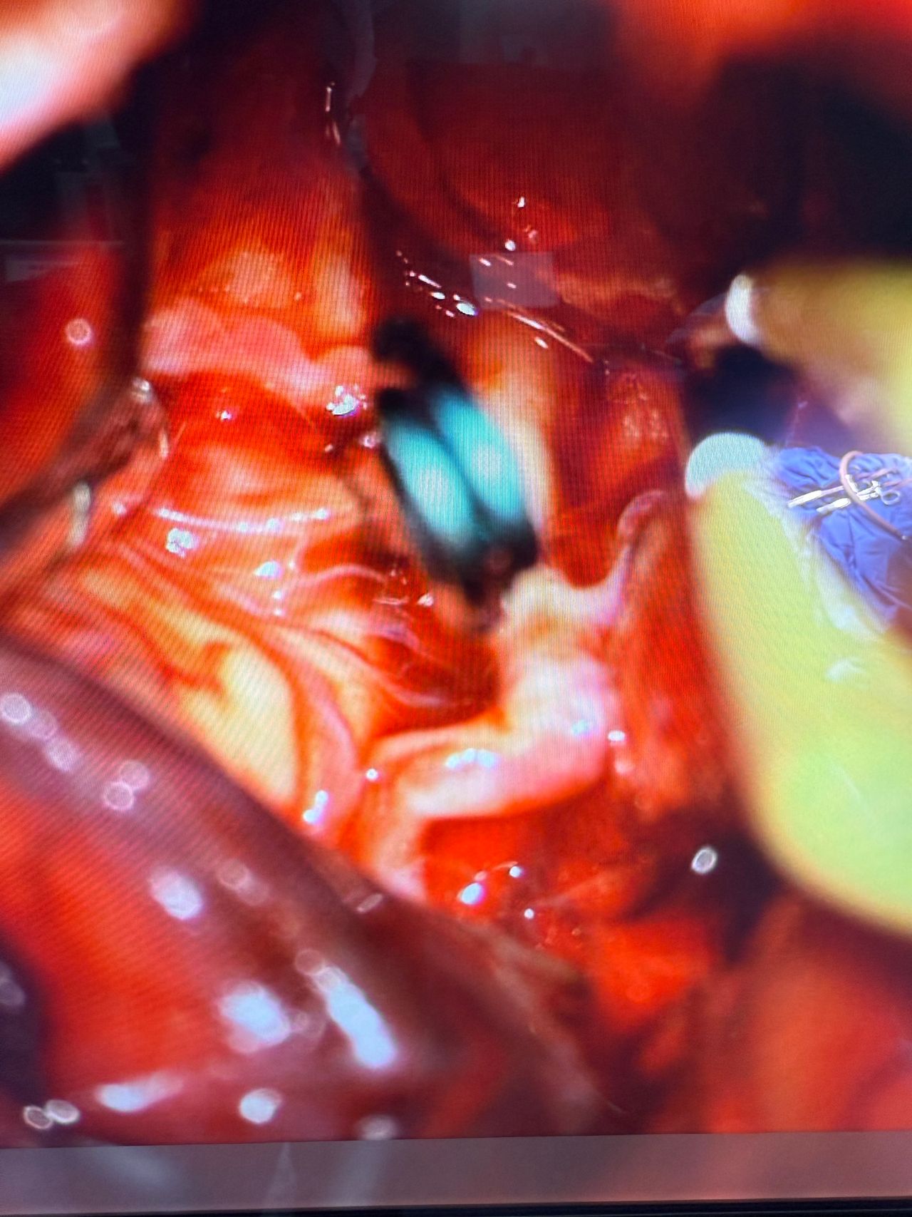 Alejandro Serrano Rubio-16