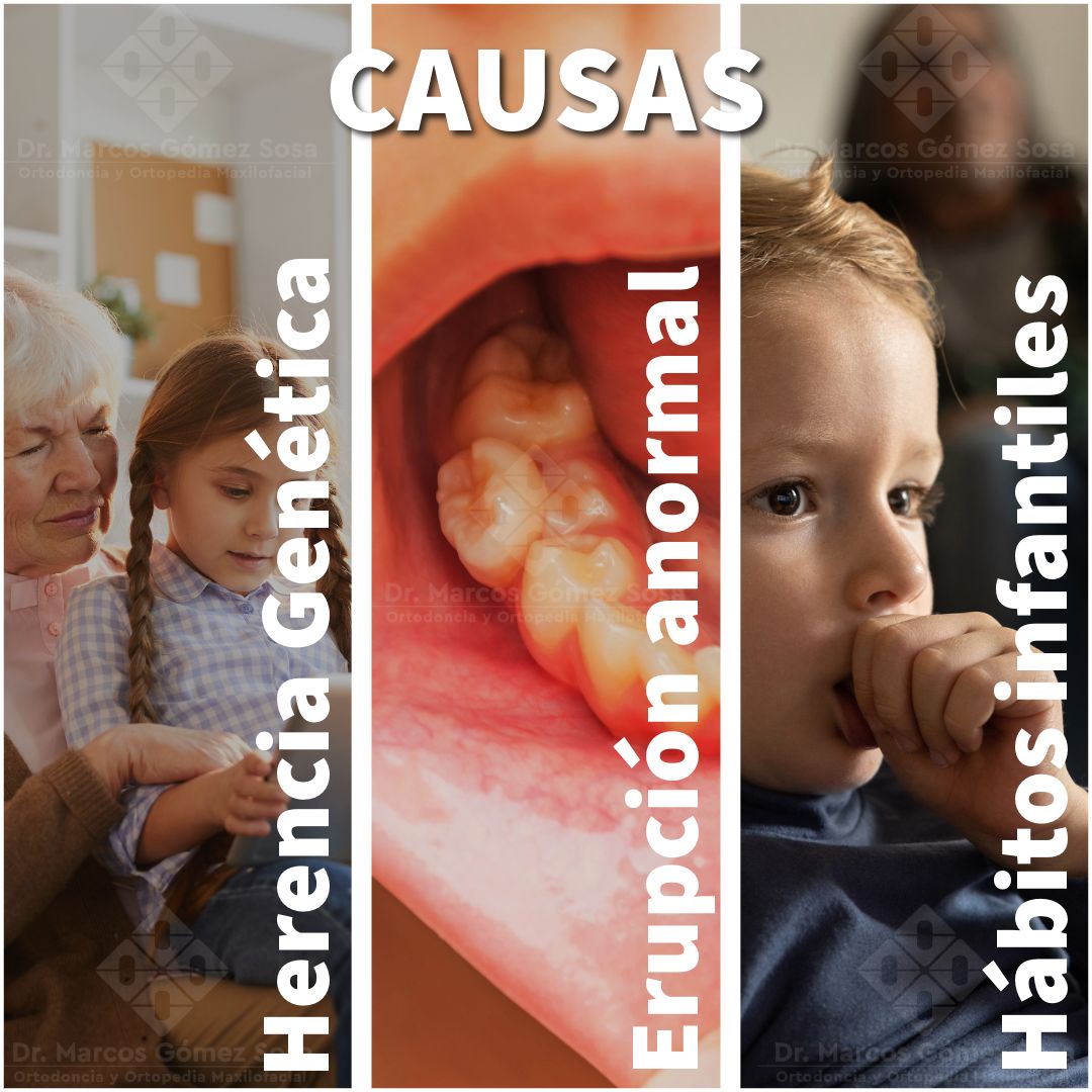 Marcos Gómez Sosa-74