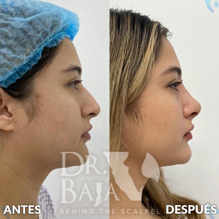 Renato Rodríguez Hirales-37