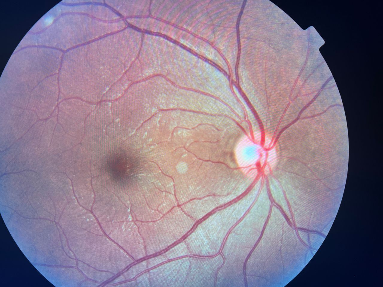 Javier Suárez Arguello-3