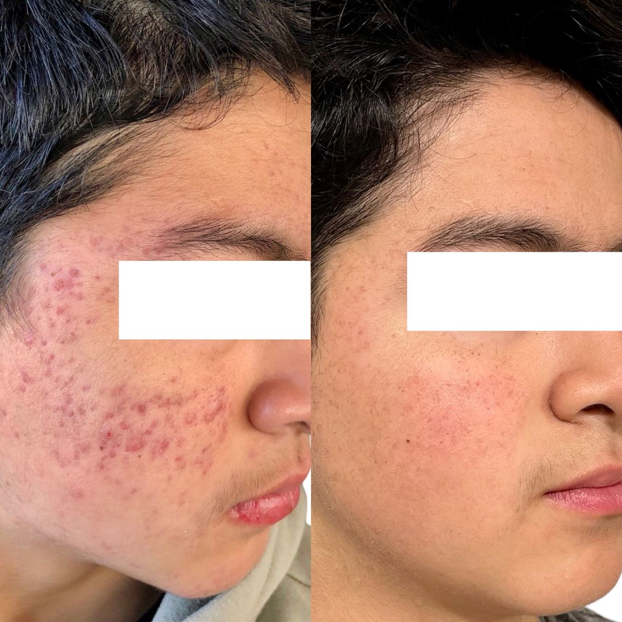 Arturo Robles Tenorio-5