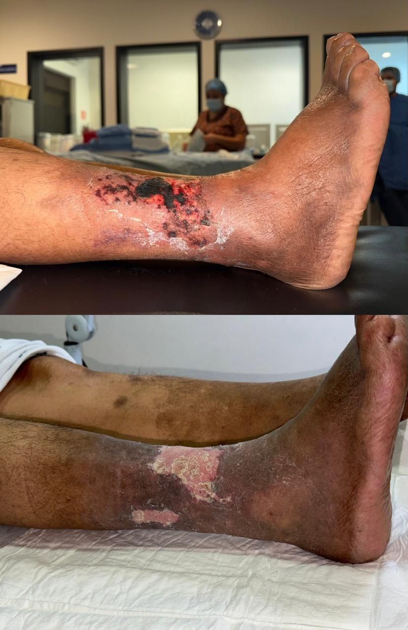 Jhonatan López González-79