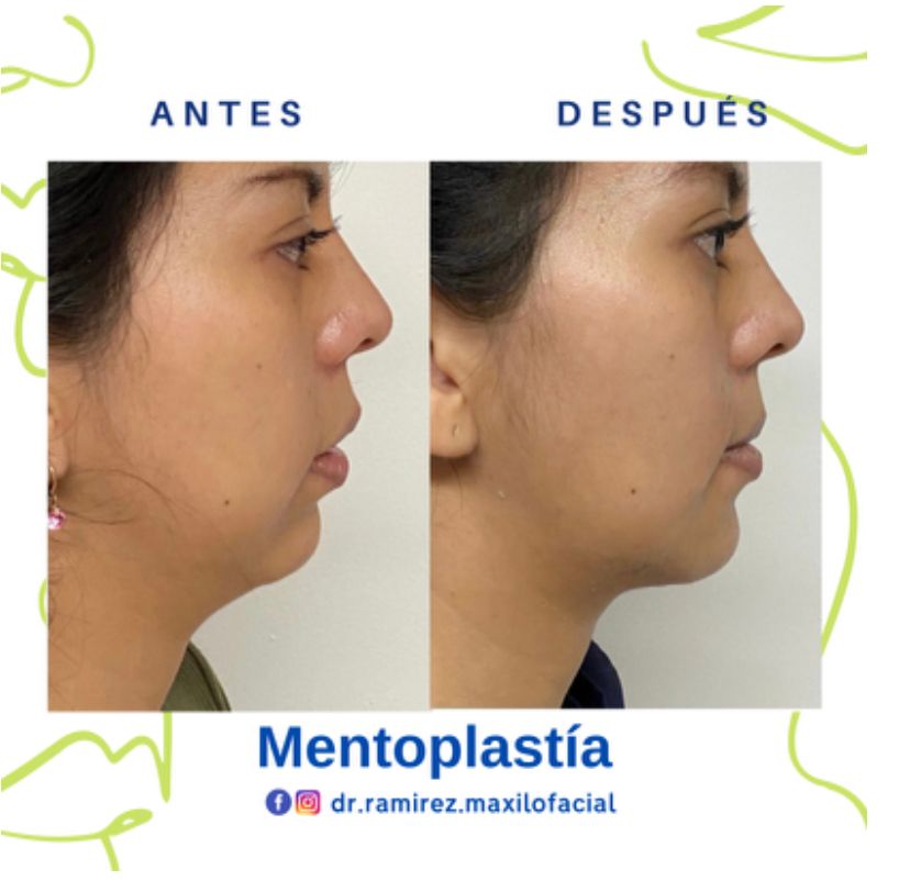 Giovani Ramírez Limón-22