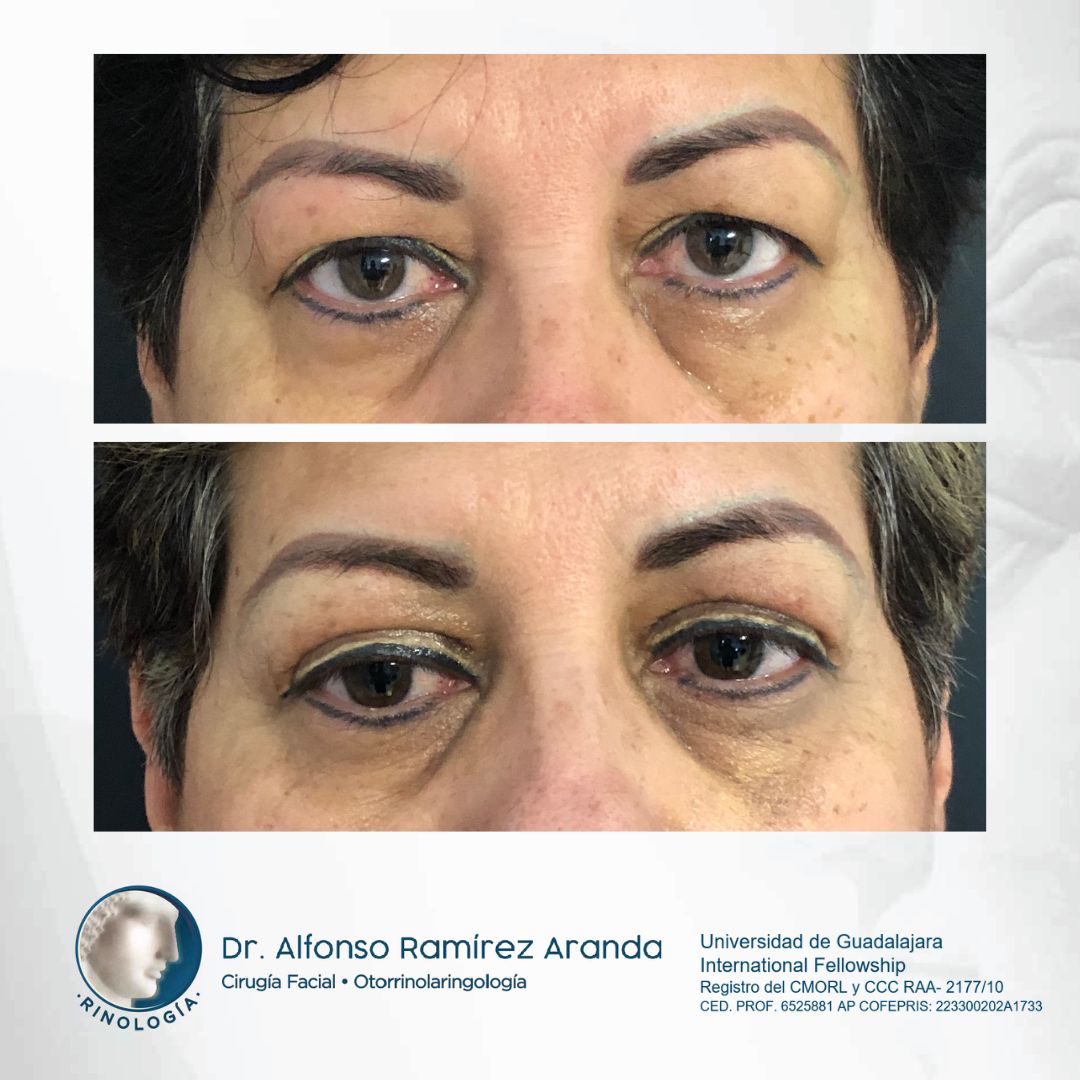 Alfonso Ramírez Aranda-4