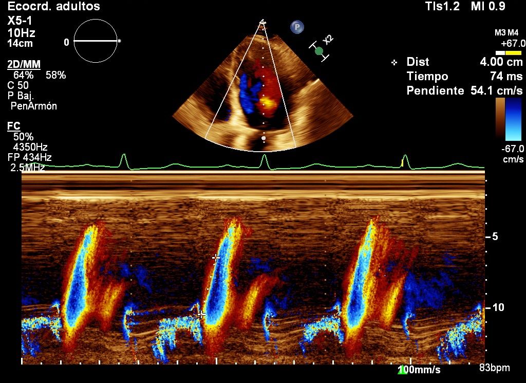 Heriberto Pruneda Ayala-9